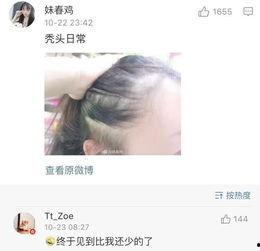 秃崽被爆料视频在线观看,揭秘背后惊人真相 第2张 秃崽被爆料视频在线观看,揭秘背后惊人真相 第2张